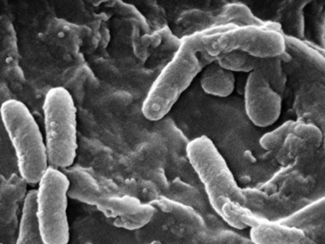 Des traitements innovants transforment l’avenir des patients atteints de mucoviscidose