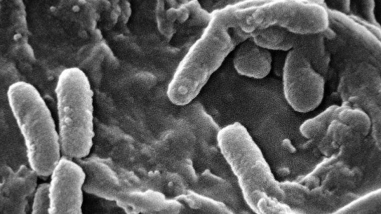 Des traitements innovants transforment l’avenir des patients atteints de mucoviscidose