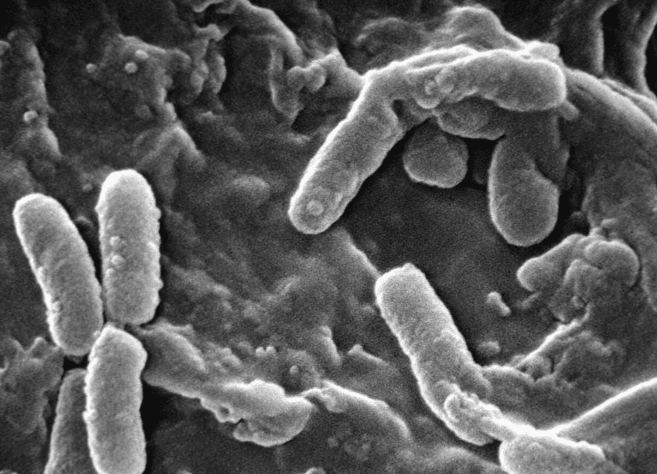 Des traitements innovants transforment l’avenir des patients atteints de mucoviscidose