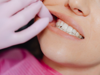 Au Japon, un médicament expérimental entre en phase d’essais humains pour stimuler la repousse naturelle des dents.