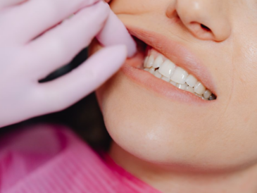 Au Japon, un médicament expérimental entre en phase d’essais humains pour stimuler la repousse naturelle des dents.