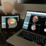 Une start-up française a créé le premier jumeau numérique du cerveau humain.