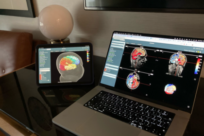 Une start-up française a créé le premier jumeau numérique du cerveau humain.