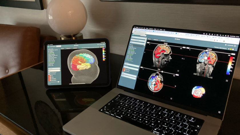 Une start-up française a créé le premier jumeau numérique du cerveau humain.