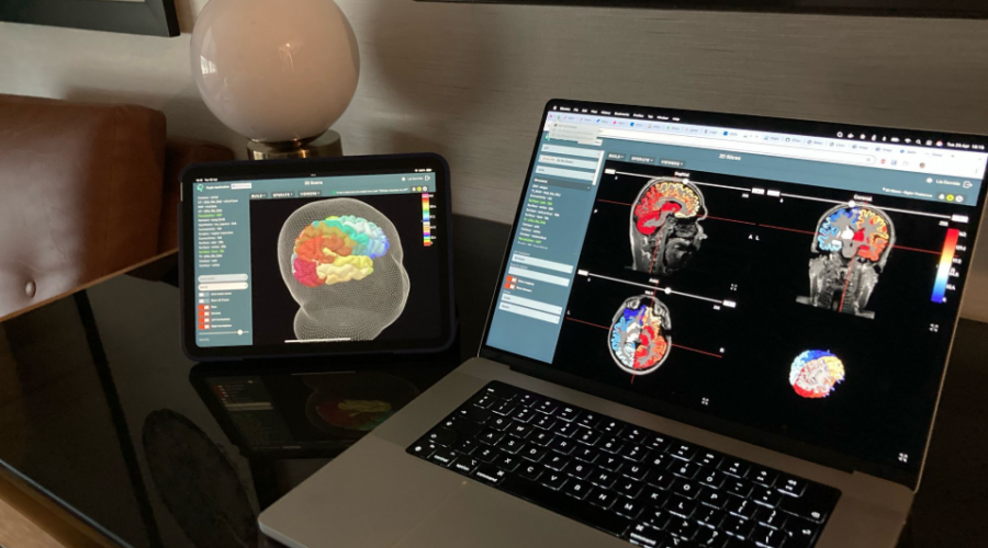Une start-up française a créé le premier jumeau numérique du cerveau humain.