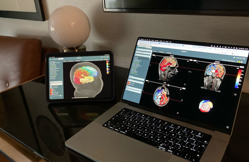 Une start-up française a créé le premier jumeau numérique du cerveau humain.