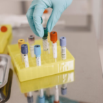 GALEAS Bladder identifie 9 cancers de la vessie sur 10 grâce à l’analyse de l’ADN urinaire