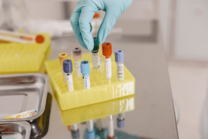 GALEAS Bladder identifie 9 cancers de la vessie sur 10 grâce à l’analyse de l’ADN urinaire