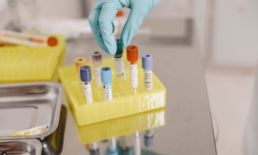 GALEAS Bladder identifie 9 cancers de la vessie sur 10 grâce à l’analyse de l’ADN urinaire