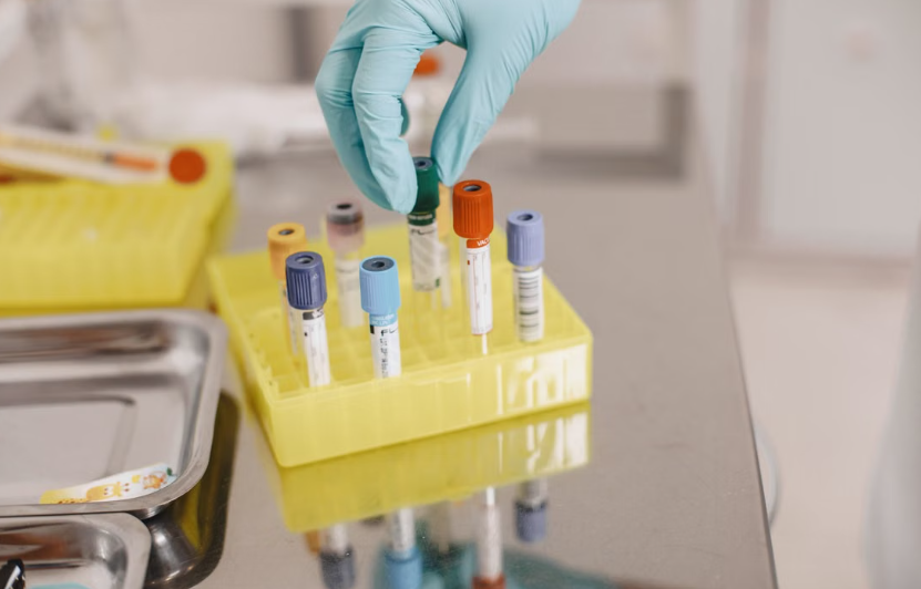 GALEAS Bladder identifie 9 cancers de la vessie sur 10 grâce à l’analyse de l’ADN urinaire