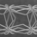 À Brest, des chercheurs développent un stent connecté imprimé en 3D capable de s’adapter à chaque artère