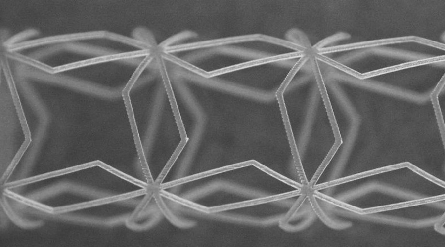 À Brest, des chercheurs développent un stent connecté imprimé en 3D capable de s’adapter à chaque artère