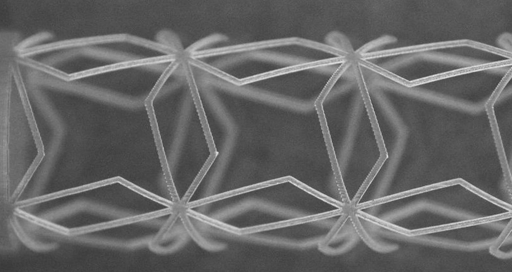À Brest, des chercheurs développent un stent connecté imprimé en 3D capable de s’adapter à chaque artère