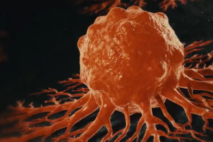 Cancer du pancréas : l’Agence européenne des médicaments recommande le Rasonque