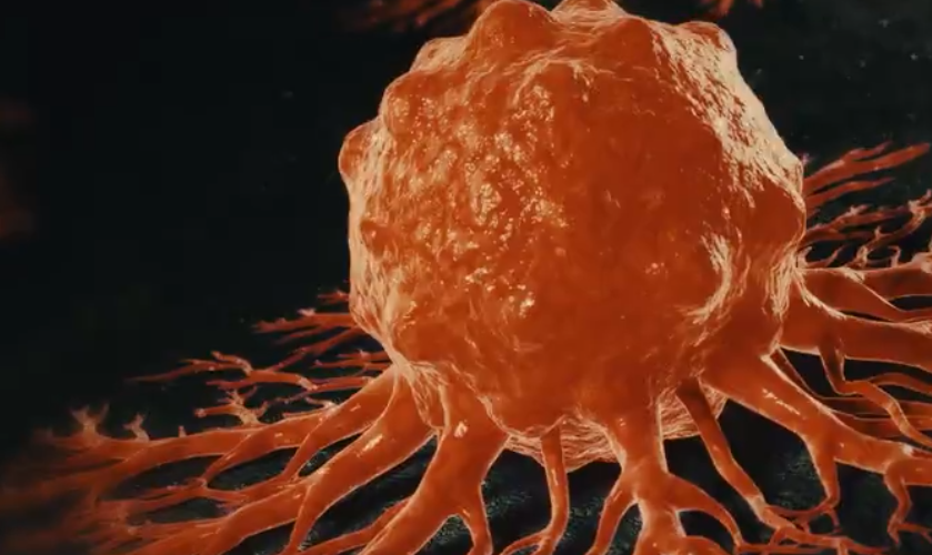Cancer du pancréas : l’Agence européenne des médicaments recommande le Rasonque